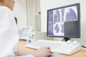 Рабочее место рентгенолога