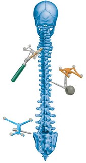 Решение для хирургии позвоночника